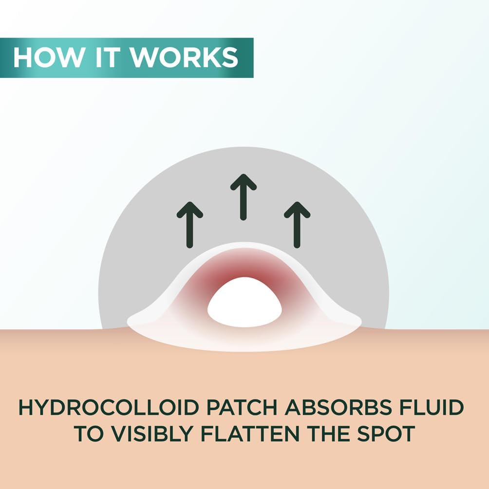 Garnier Blemish Patches, Hydrocolloid patches to reduce the appearance of spots in 8 hours, Ultra-thin & Invisible on all skin tones, Suitable For All Skin Types, Vegan Formula, 22 Patches