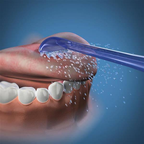 Waterpik Dental Water Jet Replacement Tongue Cleaner Tips TC100E for the WP450 or WP100