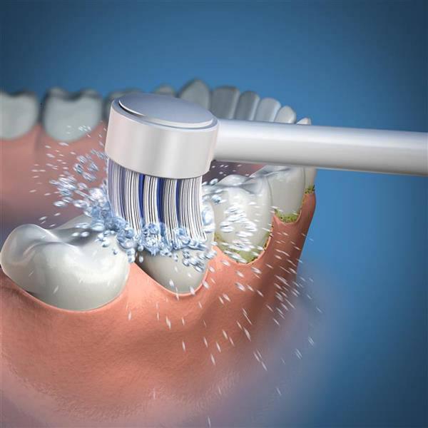 Waterpik Dental Water Jet Replacement Toothbrush Tips TB100E for the WP450 or WP100