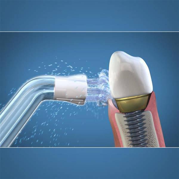 Waterpik PS-100E Water Flosser Plaque Seeker Tip - 3 Bristle Tufts - Pack of 2