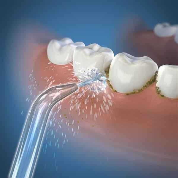 Waterpik Ultra Replacement Jet Tips JT100E for Model WP 100