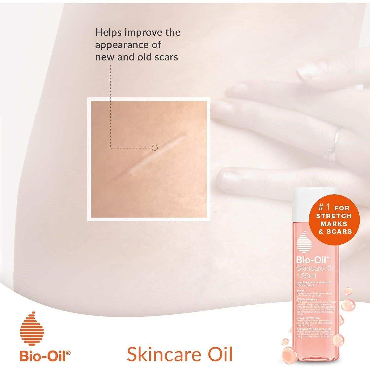 Bio-Oil Skincare Oil 125ml - Improve the Appearance of Scars, Stretch Marks and Skin Tone ,125 ml